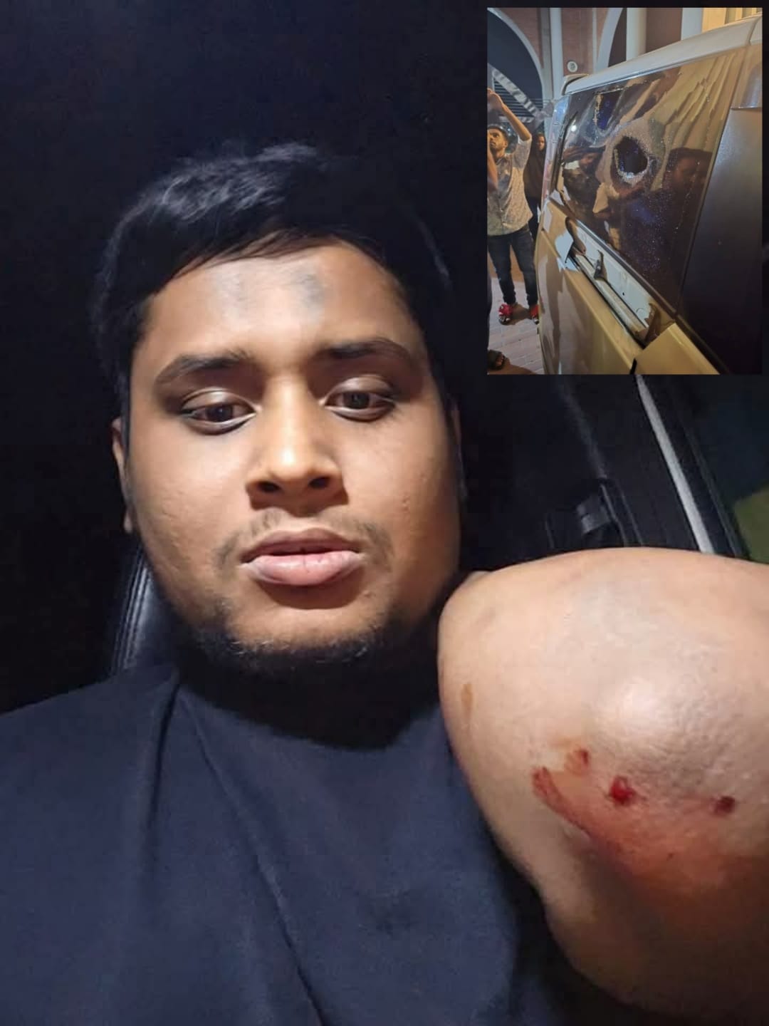 হাসনাত আব্দুল্লাহর গাড়িতে হামলা